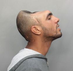 half-head-mugshot-1malformation-homme-femme-insolite.jpg