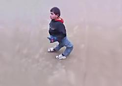 kid-with-inverted-knees-legs-jambes-malformation-enfants-malforme-maladie-rare.jpg