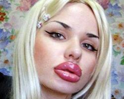 kristina-reii-100-injection-lips-pas-belle-moche.jpg