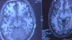 scanner-cerveau-radiographie-medecin-hopital-malade-maladie-insolite-incroyable-histoire.jpg